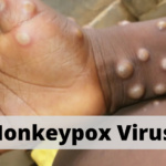 Monkeypox-virus